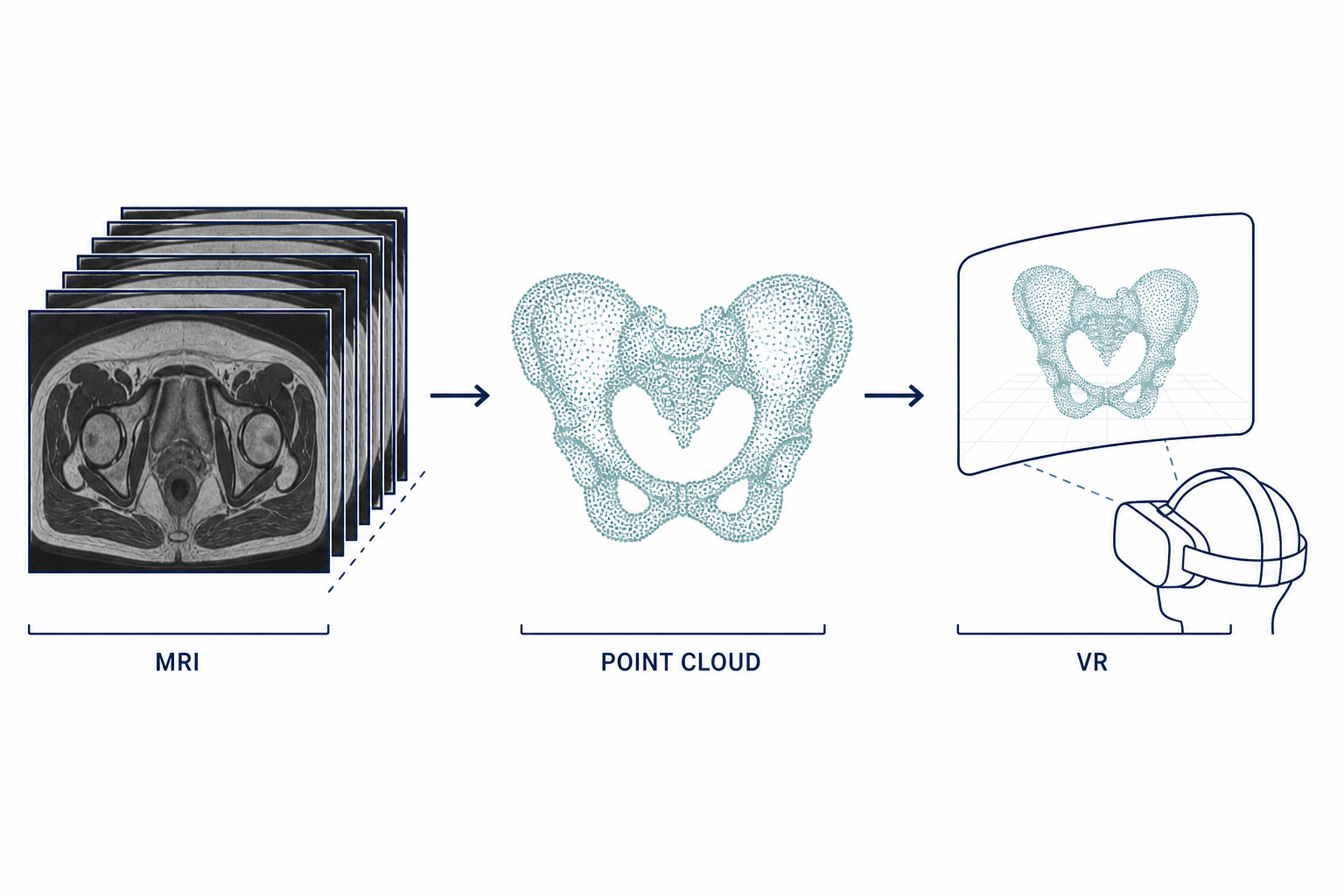 Deep Learning-Based 3D Reconstruction of the Pelvis